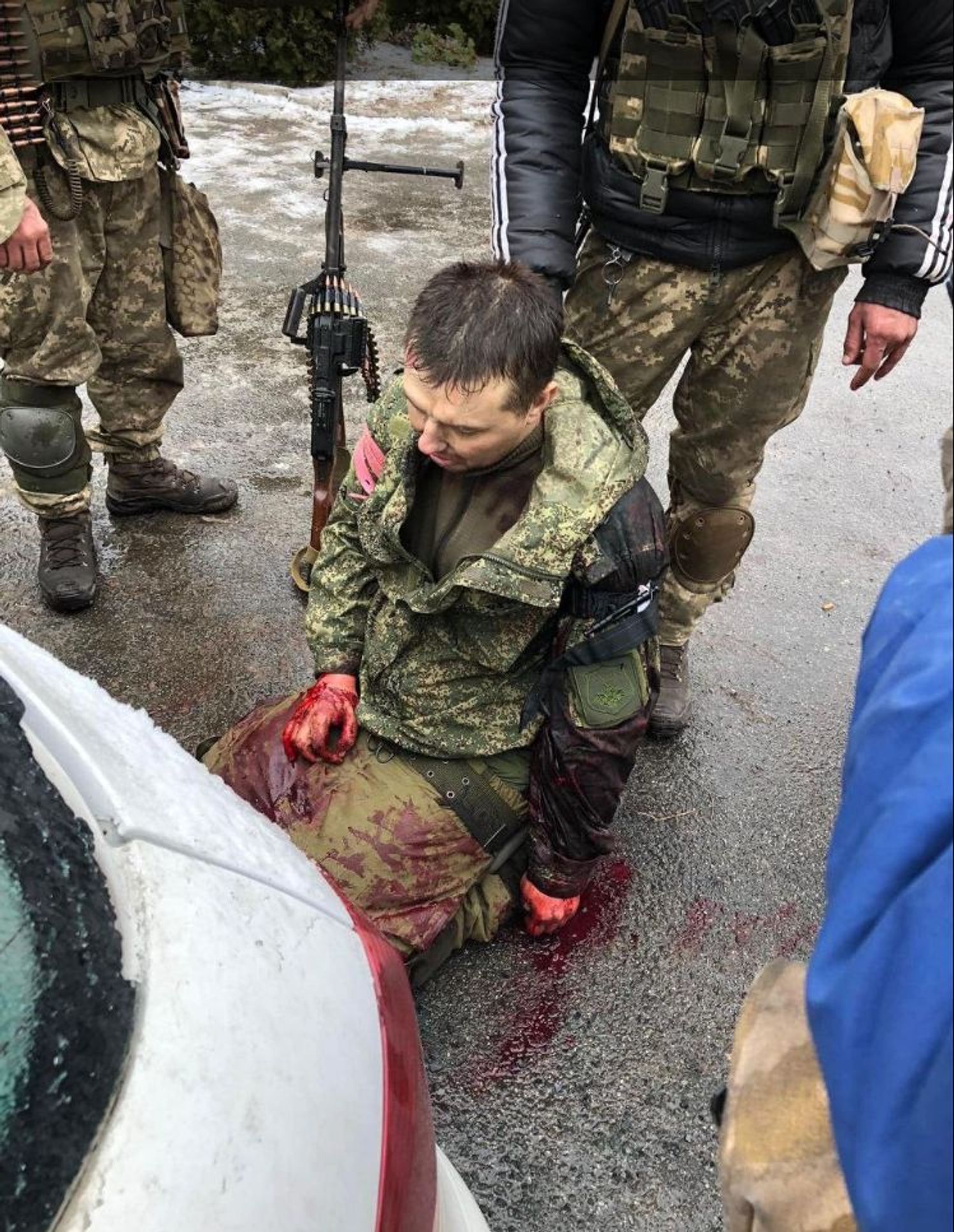 A wounded Russian serviceman with an Esmarch bandage, which was invented at the end of the 19th century